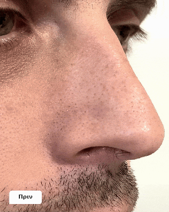 Vueskin