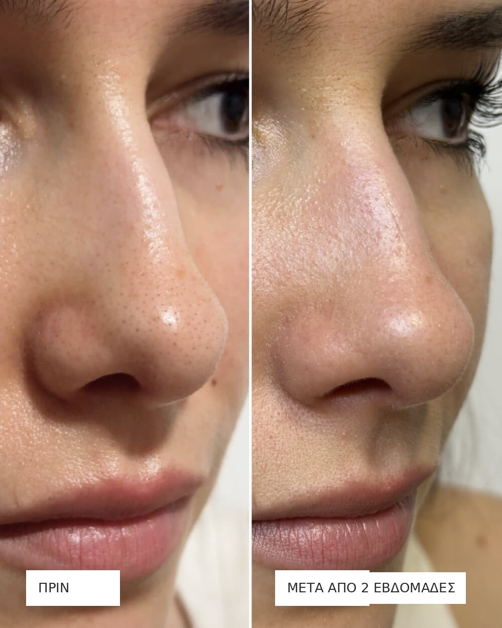 Vueskin