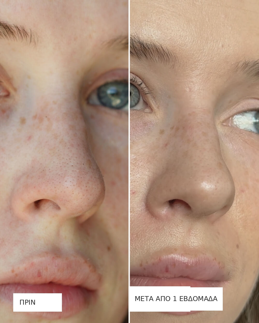 Vueskin